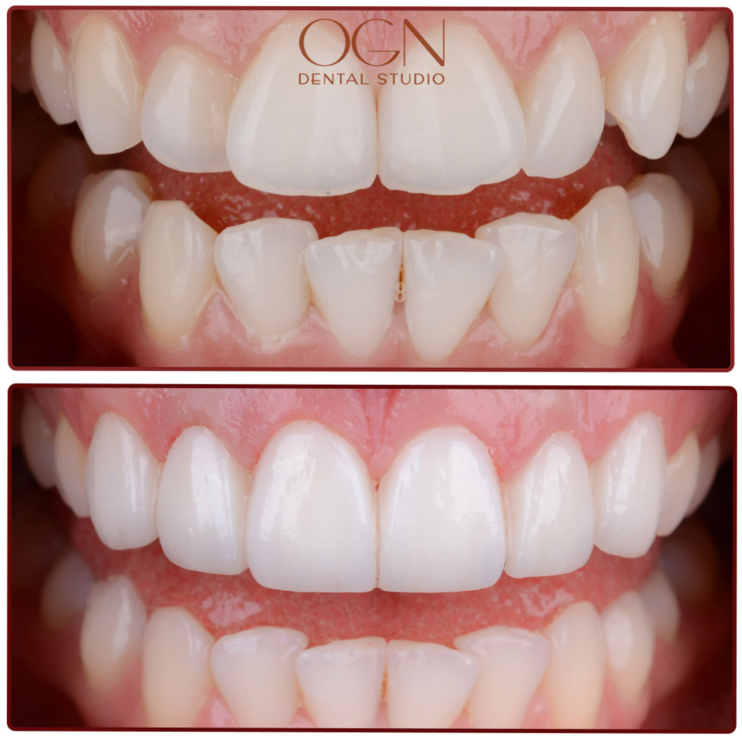 ogn dental