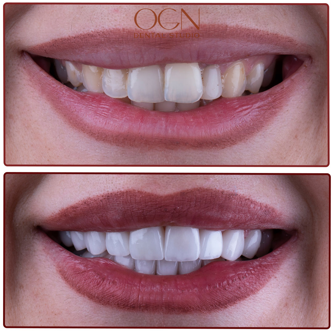 ogn dental