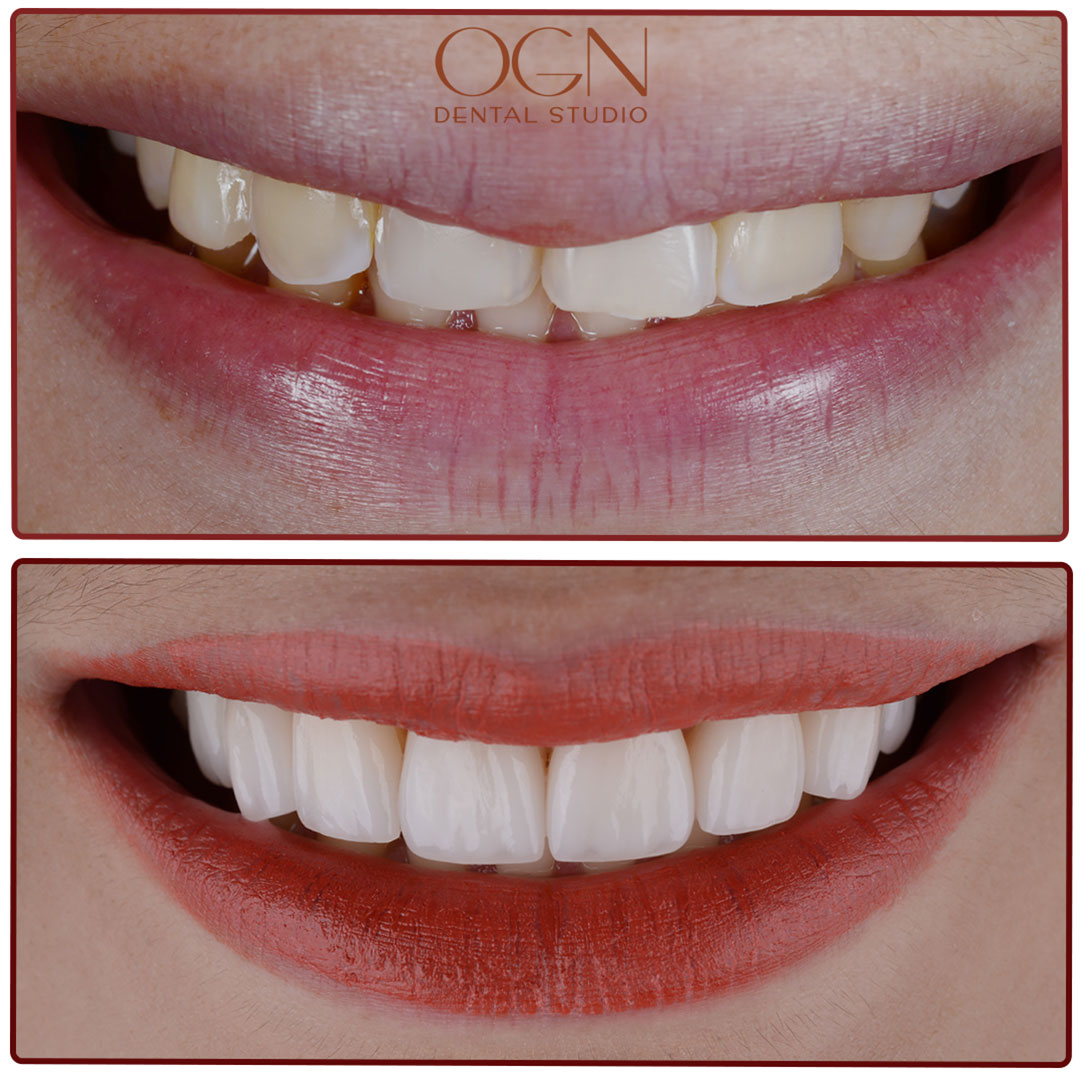 ogn dental