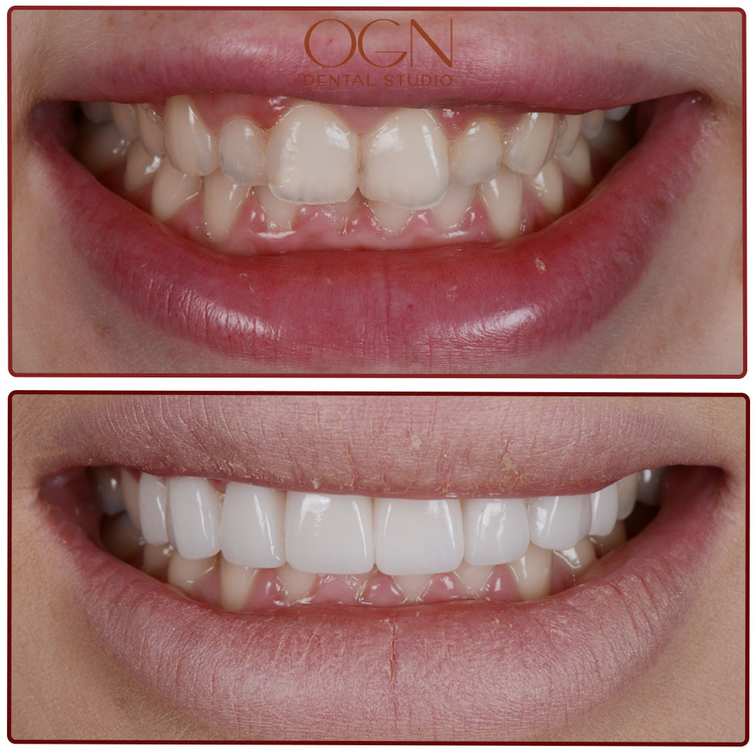 ogn dental