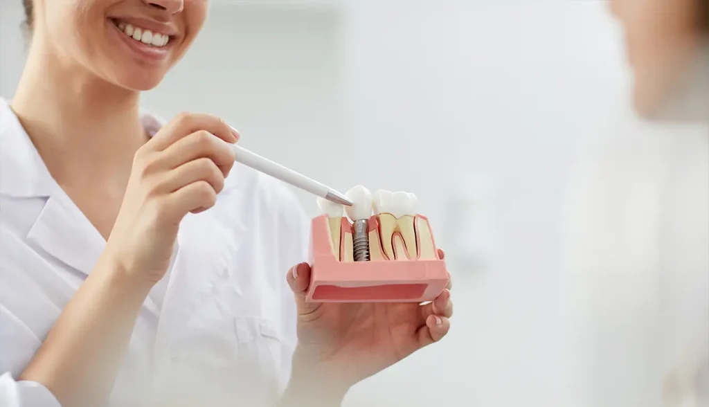 Do Implant Teeth Look Natural? 6 Implant Teeth Look Natural