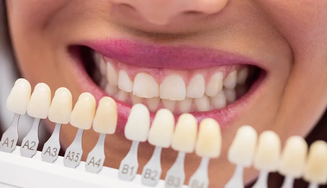 Zirconium Crowns