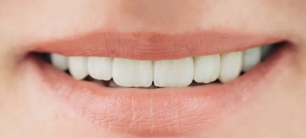 Do Zirconium Crowns Stain? 3 Zirconium Crowns