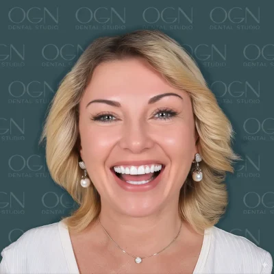 OGN Dental Studio - Smile Gallery